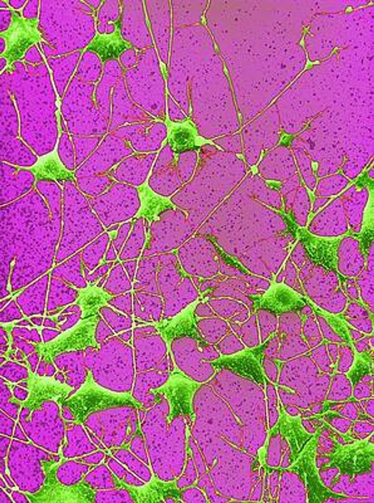 Neurons — fluorescence microscopy