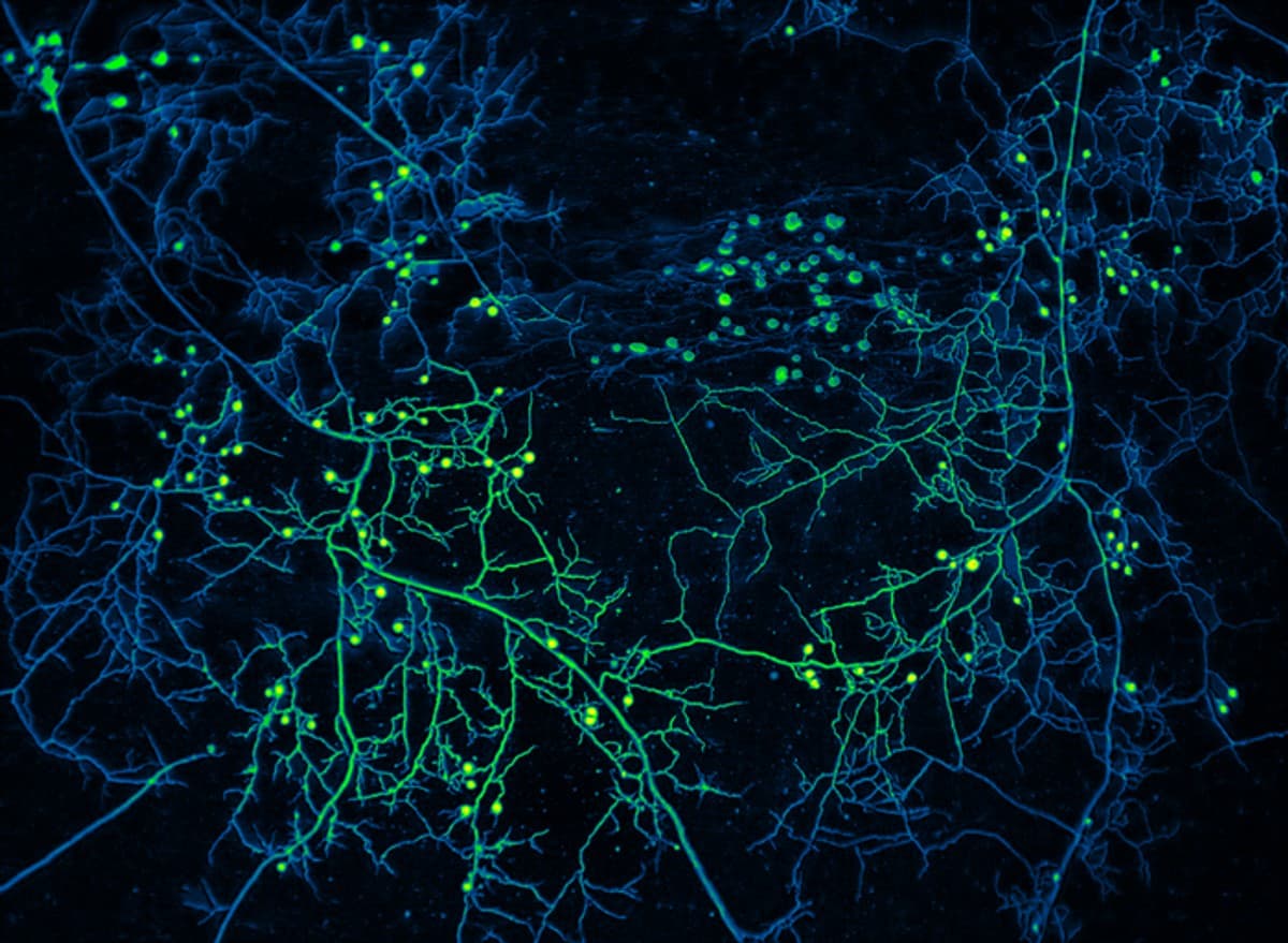 Fluorescence microscopy — neural network